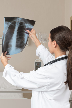 A doctor looking at chest x-ray