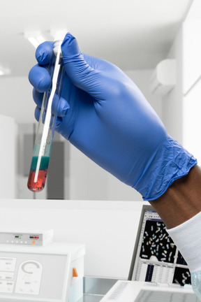 A doctor's hand holding a test tube