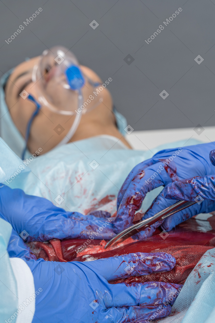 Jovem sob anestesia enquanto está sendo operado