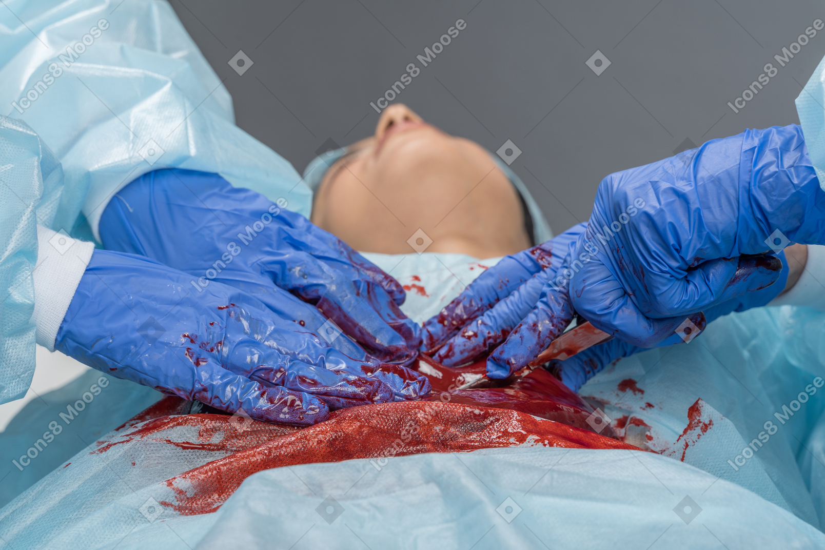 Young woman under anesthesia while being operated