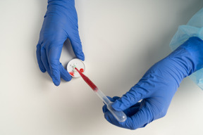 Blood probe test in laboratory