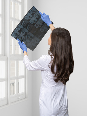 A woman in a white lab coat and blue gloves is holding x-ray