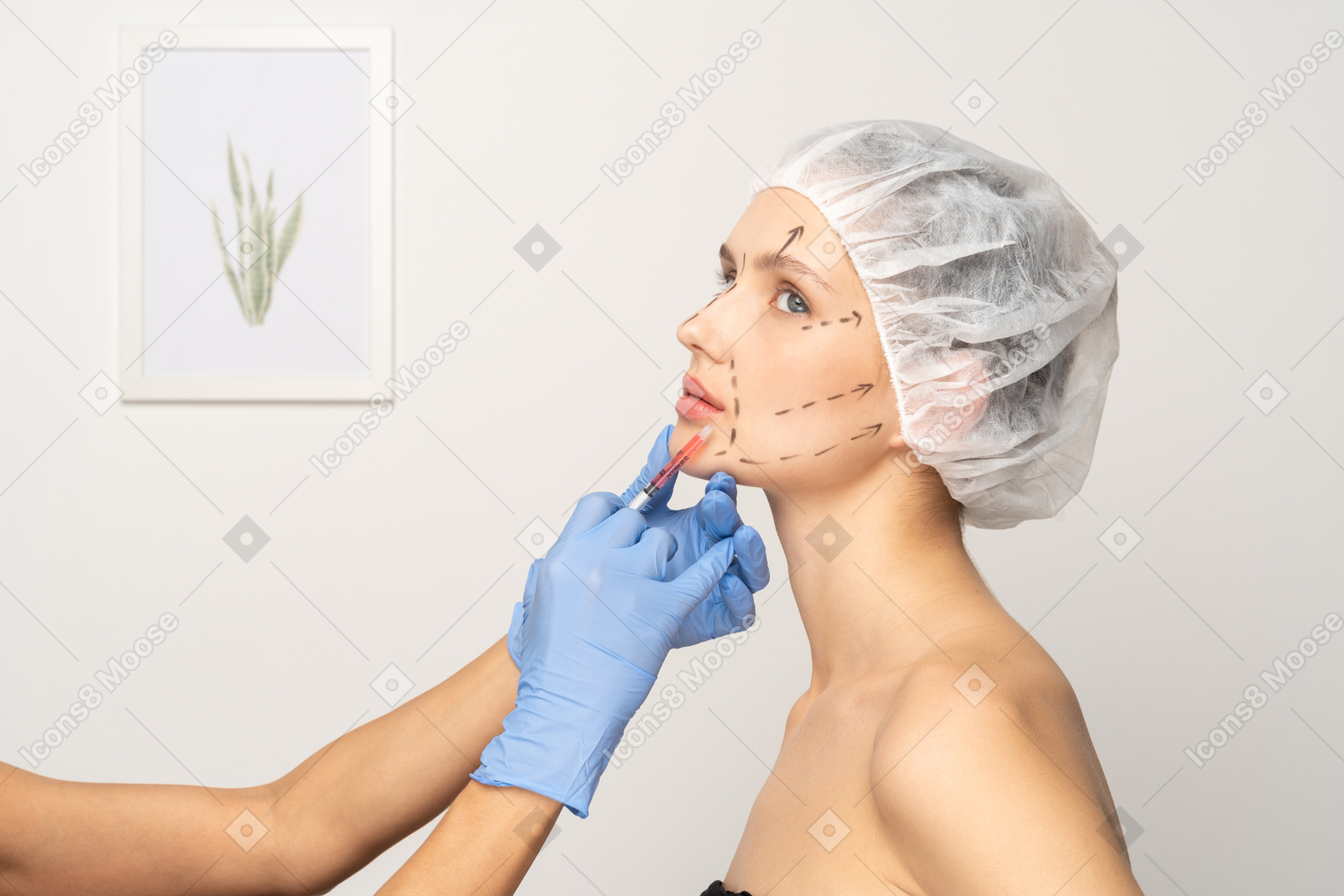 Young woman with face markings getting filler injection
