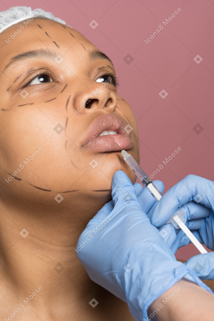 Afro american woman receiving hyaluronic acid injection