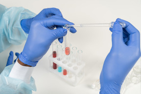 Hands in medical gloves with tubes