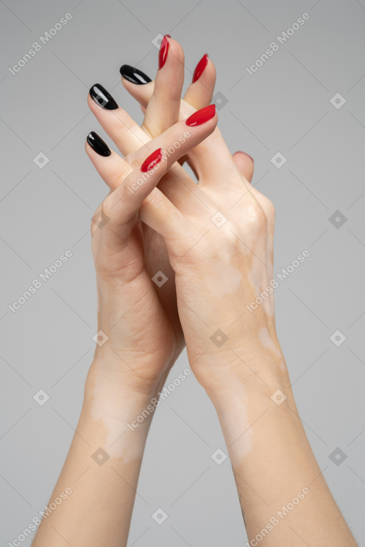 Mãos femininas com pigmentação
