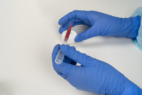 Manos en guantes y análisis de sangre