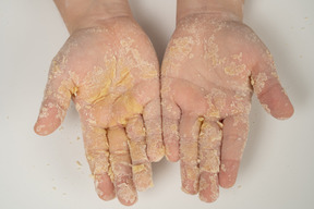 Floury hands on white background