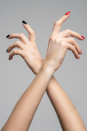 Crossed female arms with pigmentation